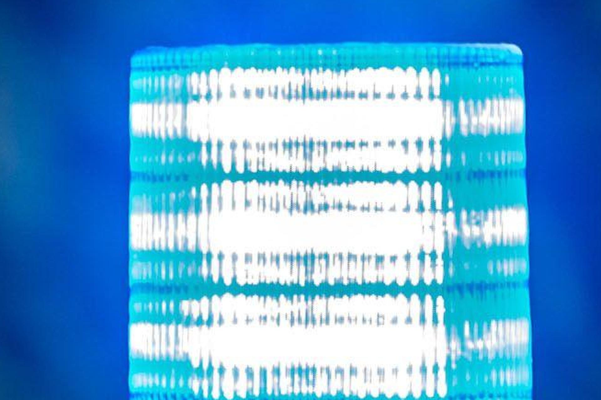 Verdächtige Beobachtungen häufen sich derzeit im Gebiet der Neustädter Polizei.  (Symbolbild: Armin Weigel/dpa)