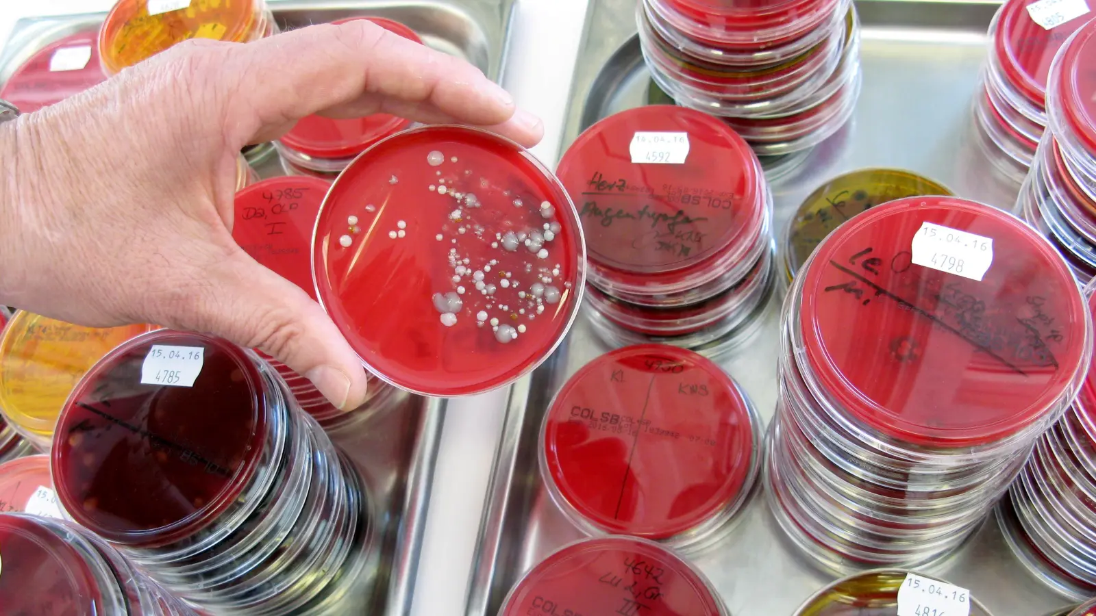 Das Landesamt für Gesundheit und Lebensmittelsicherheit hat im Zusammenhang mit einem Todesfall im Landkreis Schwandorf Proben untersucht. Nun liegen erste Ergebnisse vor.  (Symbolbild: Carolin Eckenfels/dpa)