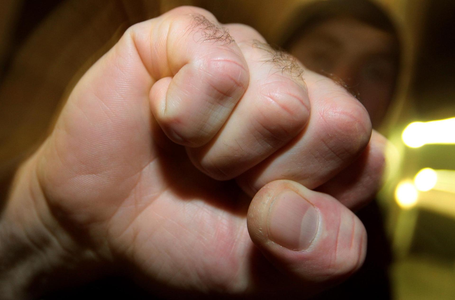 In Weiden ist es zu einer Schlägerei gekommen.  (Symbolbild:  Karl-Josef Hildenbrand/dpa)